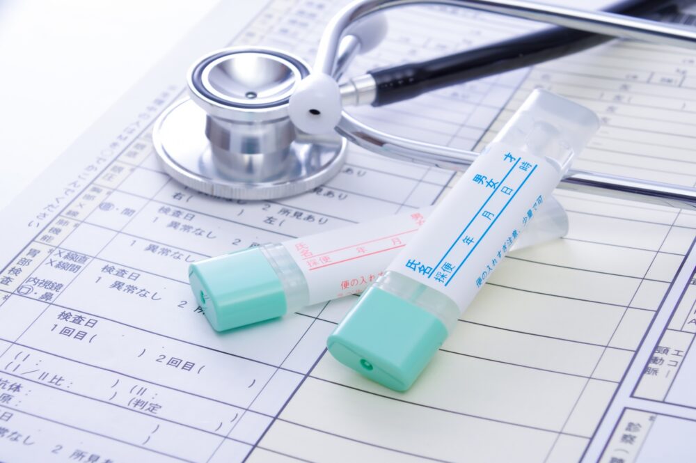 便潜血検査とは